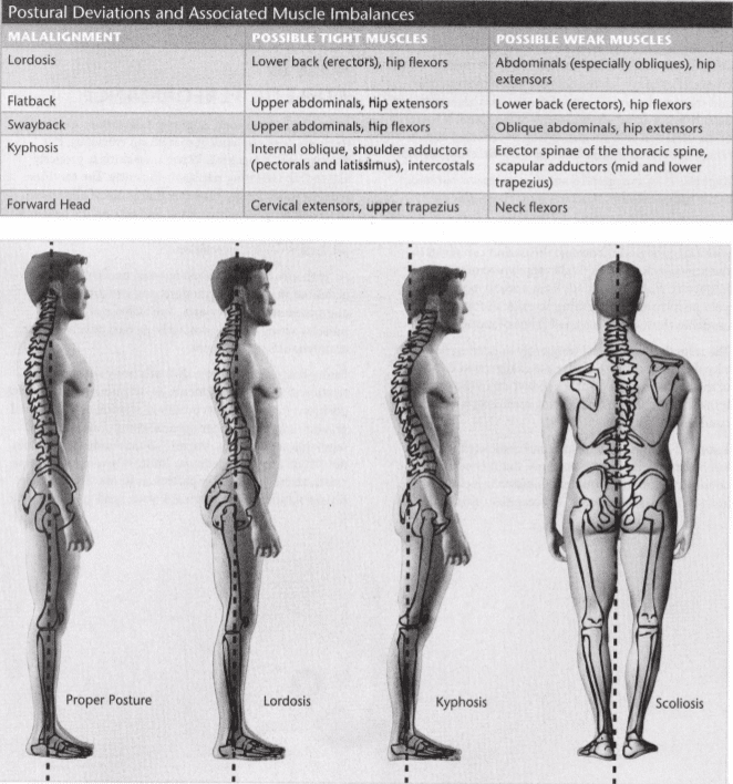 ISSA Unit 6 - Musculoskeletal deviations 7