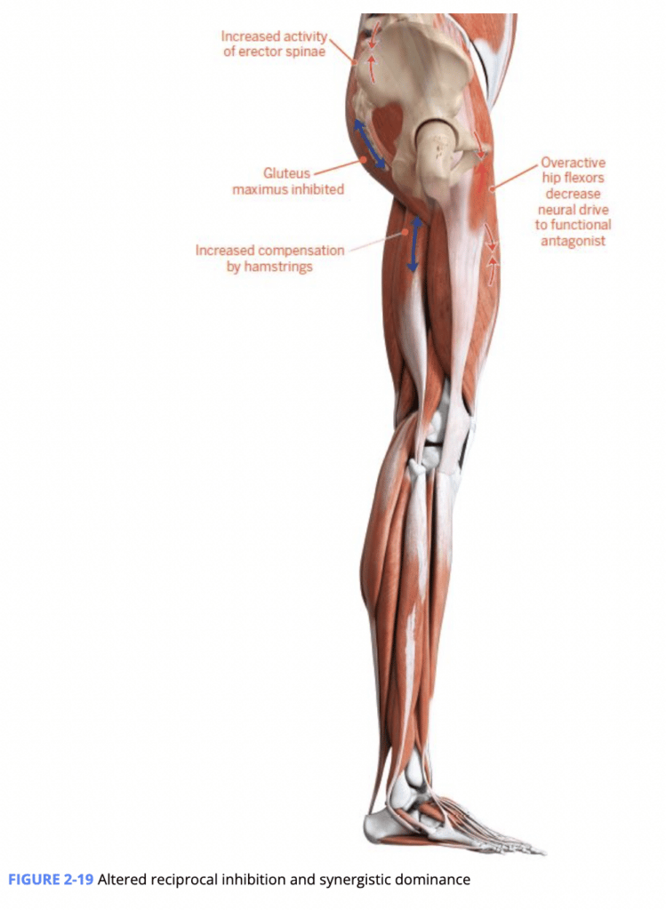 Image from NASM CES textbook showing  altered reciprocal inhibition and synergistic dominance in the leg muscles