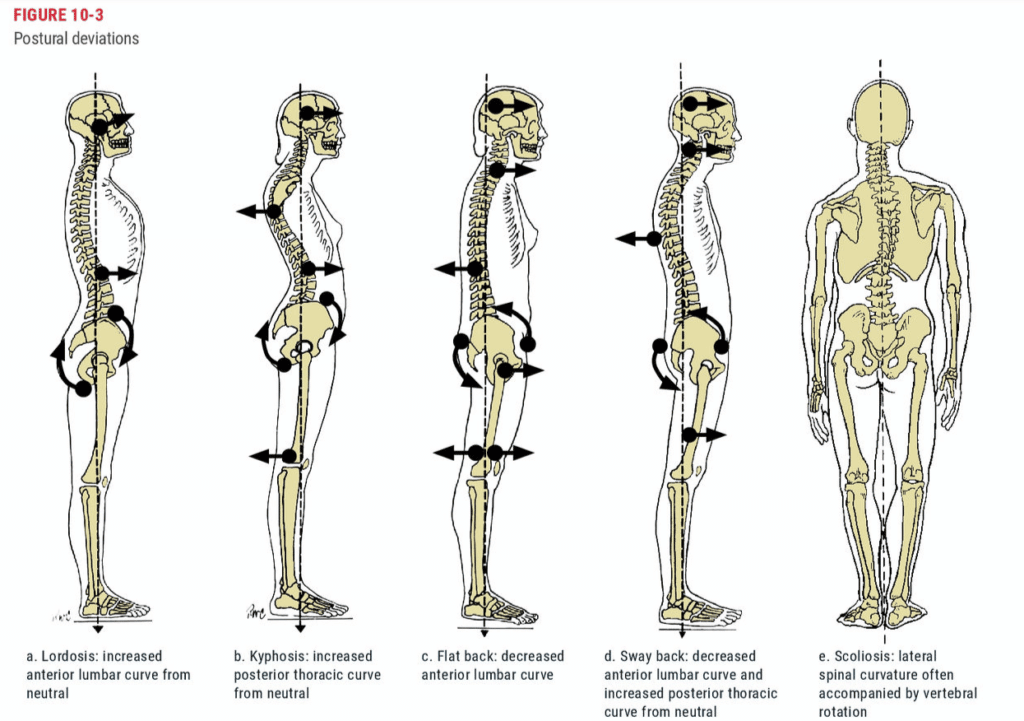 ace training curriculum static posture assessment findings