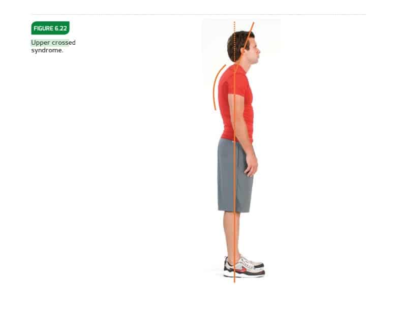 NASM figure showing upper crossed syndrome on a person from the side view